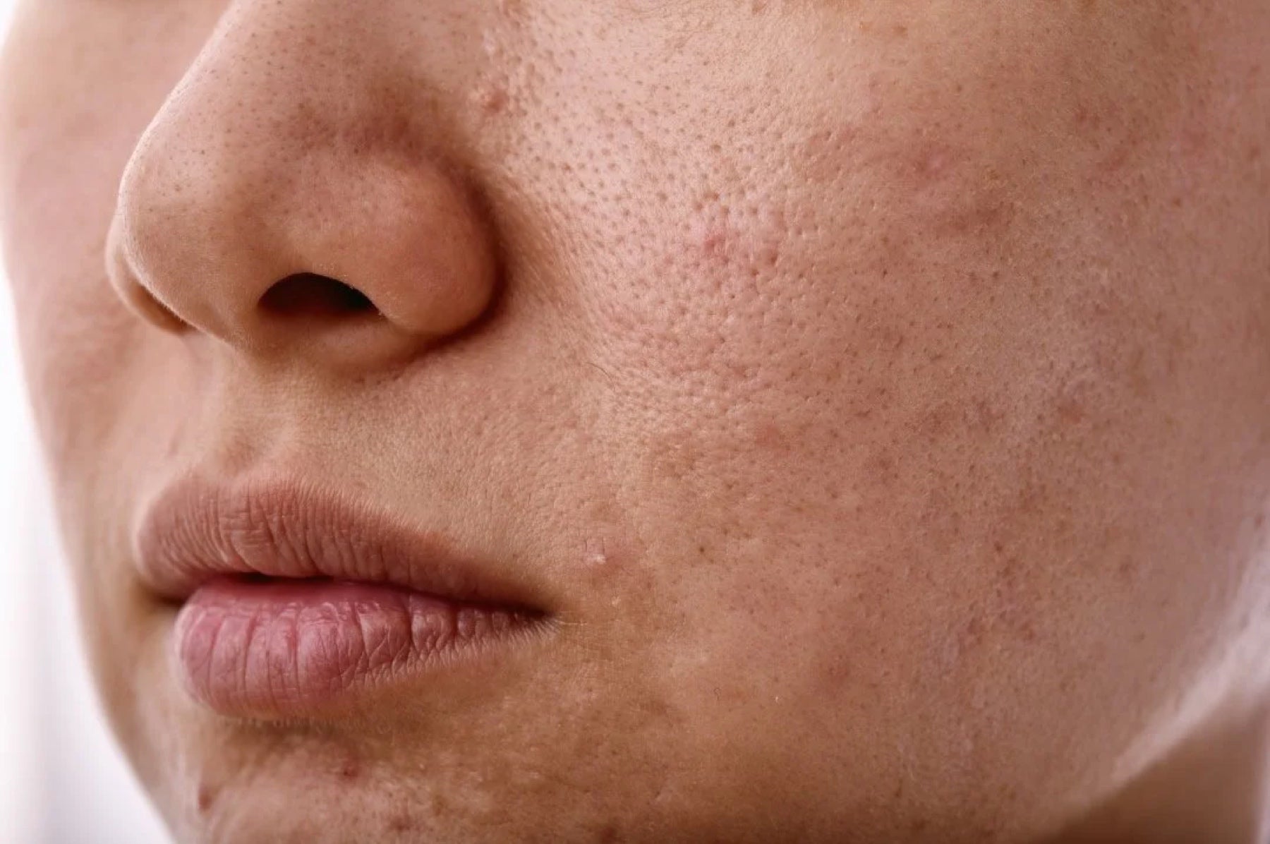 Close view of visible skin texture